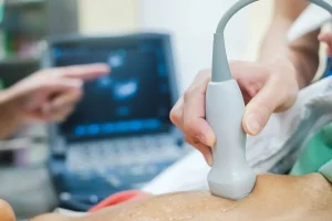 Ecocardiograma Doppler Color